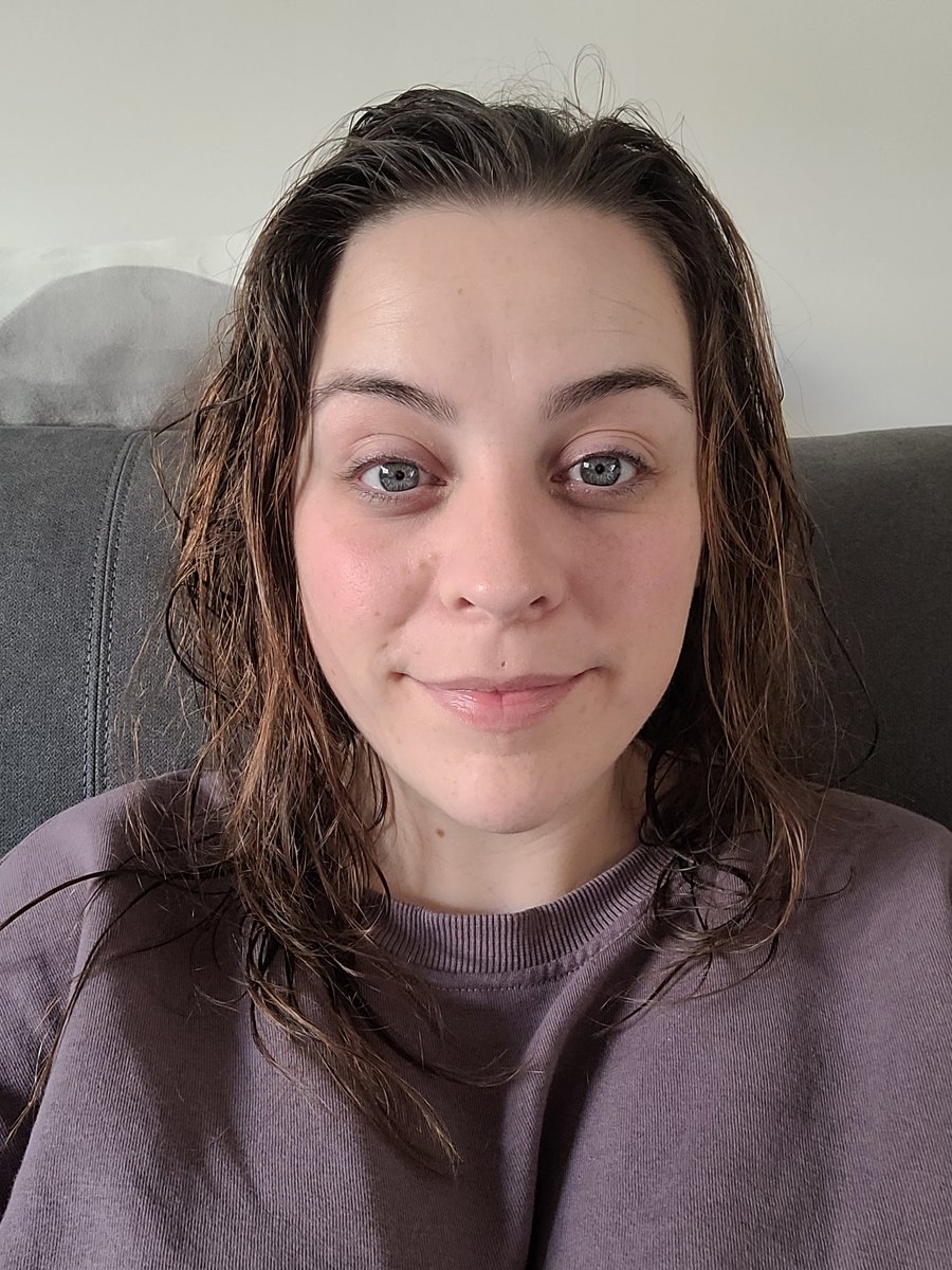 This is what 30 looks like.
Wrinkles, eye bags.. sagging skin.
It's absolutely normal, and just a natural part of ageing.