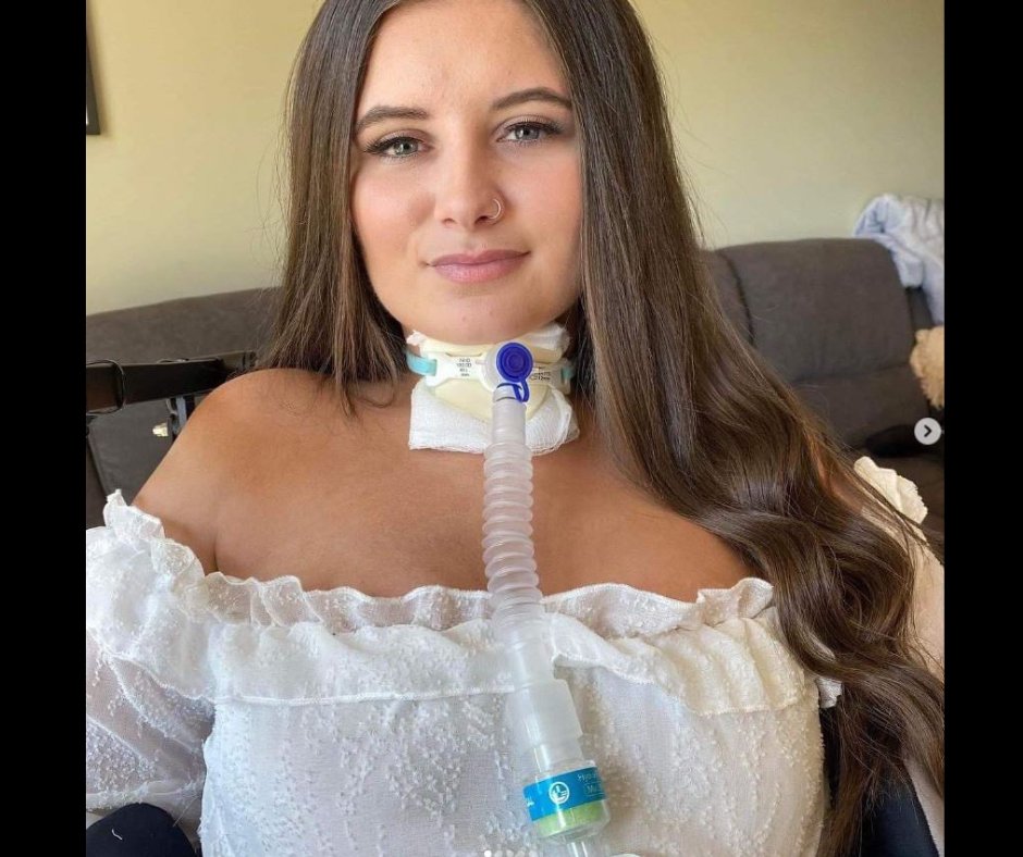 SPINALpedia's tweet image. Jannie, a quadriplegic from Australia, was injured in 2020. Injured during Covid, she has come a long way and she shares her life including continuing physical rehabilitation and her new speaking career. Follow her @janniespurpose

#quadriplegic #spinalcordinjury #Australia