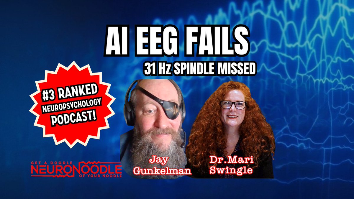 NeuroNoodle1's tweet image. AI EEG skips 31 Hz peaks — Jay: &apos;Plagiarized intelligence.&apos; Phenotypes crush DSM (85% med wins). Home NF? Context kills. Jay Gunkelman &amp;amp; Dr. Mari Swingle expose it all.

Watch: youtu.be/ZXxl3KuHo1E

#NeuroNoodle #AIErrors #QEEGPhenotypes