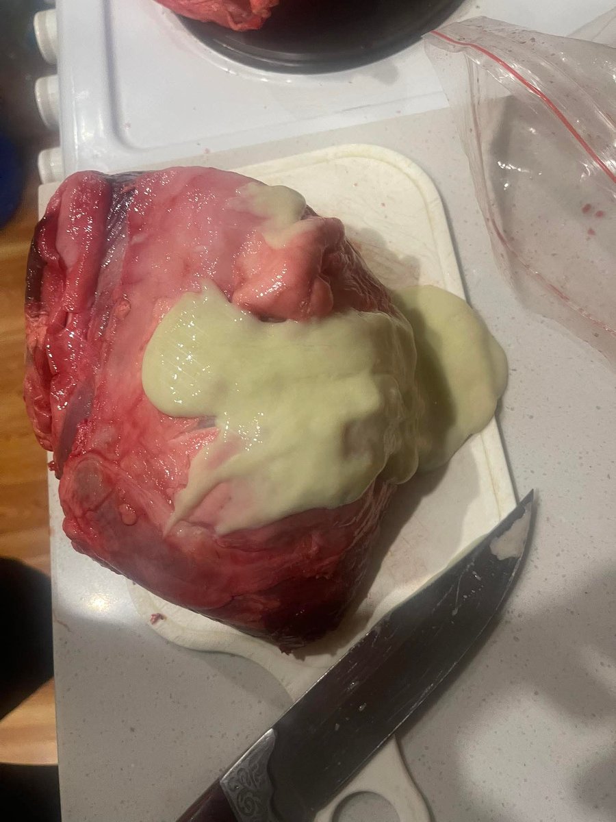 Хүчит шонхороос авсан мах гэнээ...

Бид хэзээ энэ малын тариа вакцинаа янзлах юм бгаан. Иргэд Антибиотикийн дадалд ороод өвчин нь эдгэхгүй яваад байгааг ЭМЯ нь мэддэг л байлгүй дээ. Энэ мат асуудлыг сууриар нь засаасай