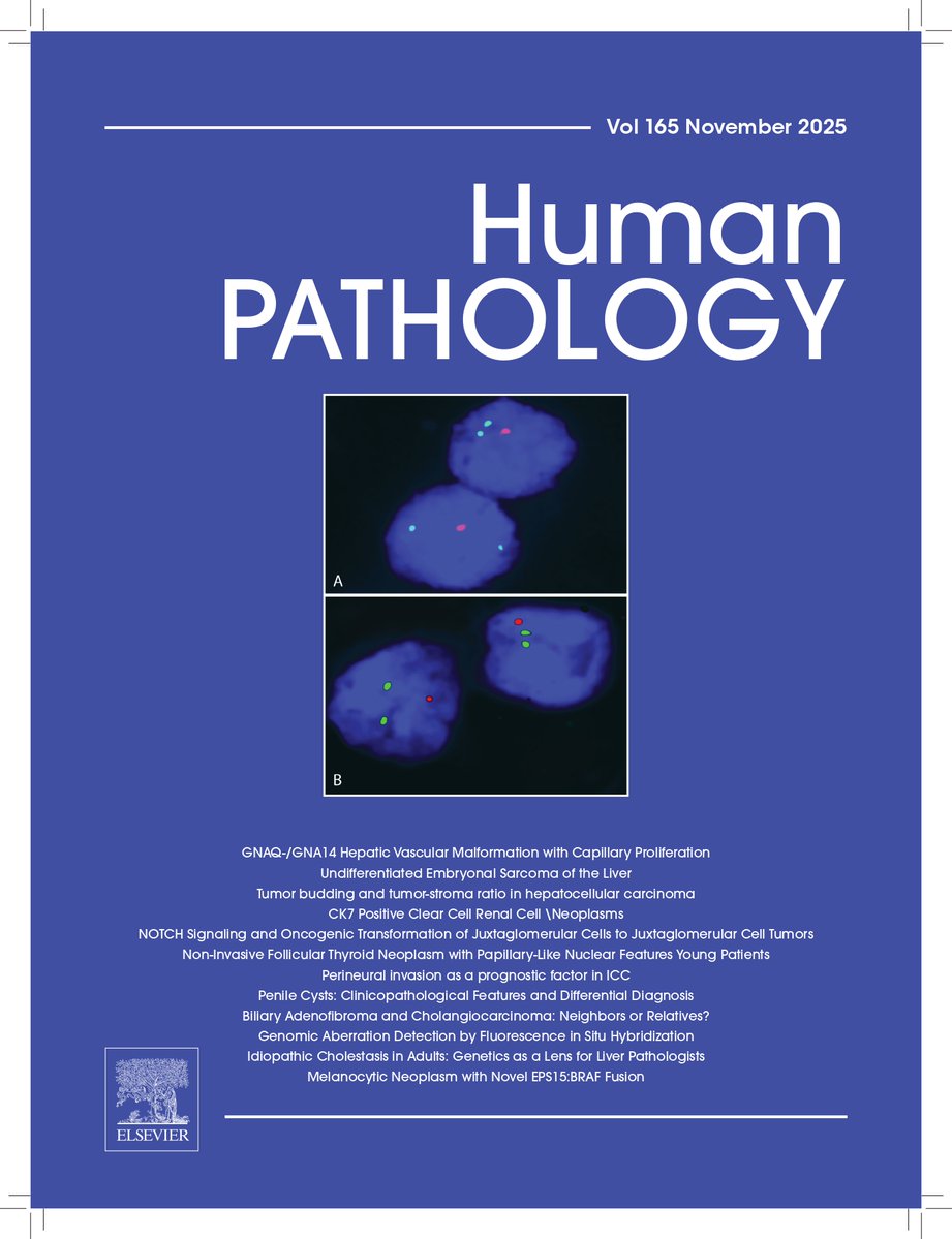 Human_Pathology's tweet image. The November 2025 issue of #HumPathol is available online! sciencedirect.com/journal/human-… #pathology #PathTwitter #PathX