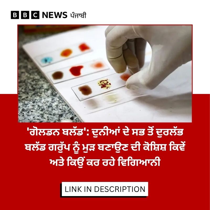 bbcnewspunjabi's tweet image. Rh-null ਬਲੱਡ ਗਰੁੱਪ ਇੰਨਾ ਦੁਰਲੱਭ ਹੈ ਕਿ ਅਜੇ ਤੱਕ ਇਹ ਦੁਨੀਆਂ ਦੇ ਸਿਰਫ 50 ਲੋਕਾਂ ਵਿੱਚ ਹੀ ਪਛਾਣਿਆ ਗਿਆ ਹੈ। ਪੜ੍ਹੋ ਪੂਰੀ ਖ਼ਬਰ- bbc.in/4pcoB3K
#science #BloodGroup