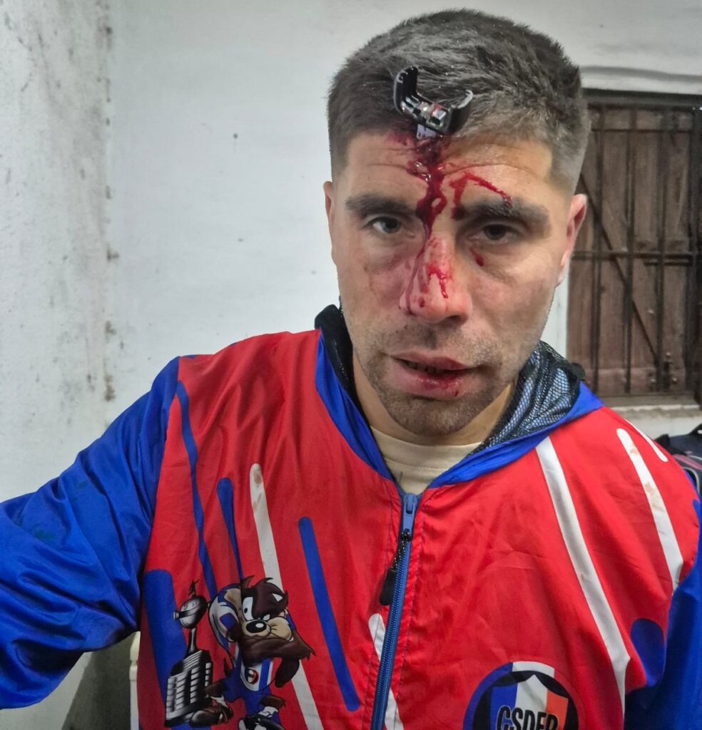 enlamiraradio's tweet photo. 🚨 Berazategui. Violencia en Villa España: Jonathan José Smith, ex jugador de la ADB, fue apuñalado con una llave de auto en la cabeza durante una pelea en un partido Sub 16 en el Club GEVE. Testigos dicen que intentó defender a un amigo. Está internado
#Violencia #Fútbol #GEVE https://t.co/eVts15LKS4