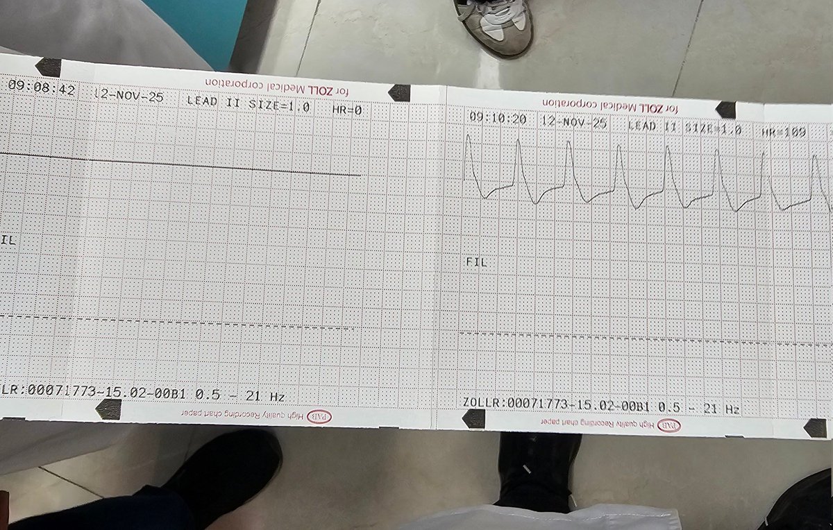 drpain_fa's tweet photo. فاصله‌ی بین مرگ و زندگی توی cpr
چندتا مربع. https://t.co/cm5MkzvDCN