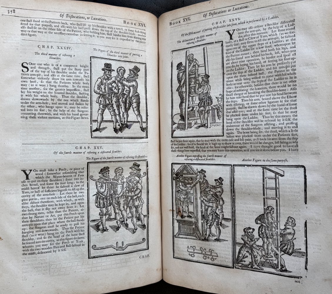 This is exactly how I remember my orthopedics rotation in med school.