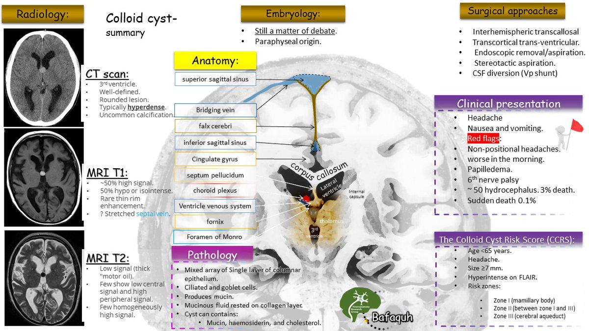 The Neuroanatomy Research Group is launching a series of oral mock exam sessions this Saturday (November 15, 2025) 🧠✨

A targeted group of participants has already been arranged—get ready for focused, high-yield preparation. 📚🔥

Full review of a Neurosurgical condition in one