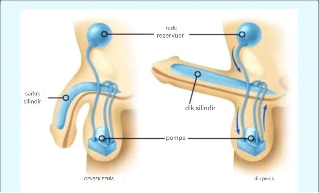 SERTLEŞME DİSFONKSİYONU 36 yaşında, kendine güvenen ve yeni evliydi. Dışarıdan bakıldığında her şeyi yoluna koymuş bir adam gibi görünüyordu: istikrarlı bir işi, güzel bir eşi ve parlak bir geleceği vardı. Ama kapalı kapılar ardında, gururunu yerle bir eden sessiz bir mücadele