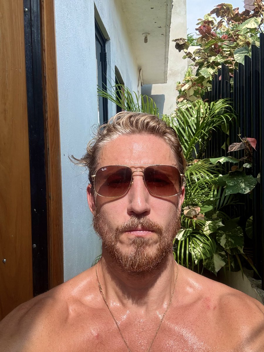 shriblets's tweet photo. Doc says I already got skin cancer so this is fine https://t.co/dRQOdFgJy7