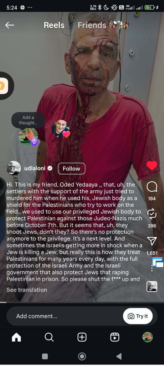 <a href="/PoliticsJOE_UK/">PoliticsJOE</a> Meanwhile, this Jewish man was almost murdered by violent Israeli settlers — under the protection of the IDF — simply because he tried to protect Palestinians.

And he said what? “IDF is everybody”?
Yeah — everybody who doesn’t have a shred of humanity left in them.