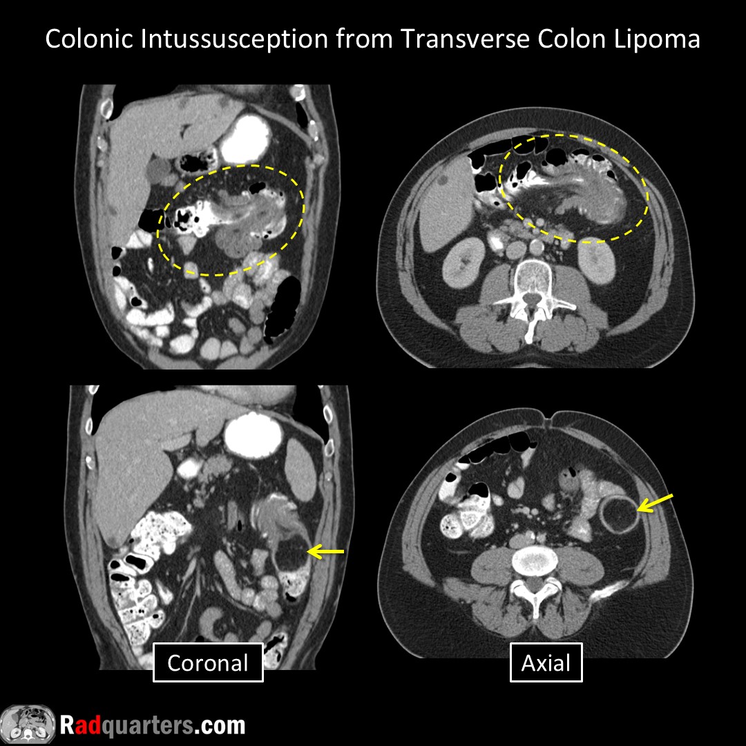 #FOAMrad #FOAMed #radres #radtech #medstudent #radquarters