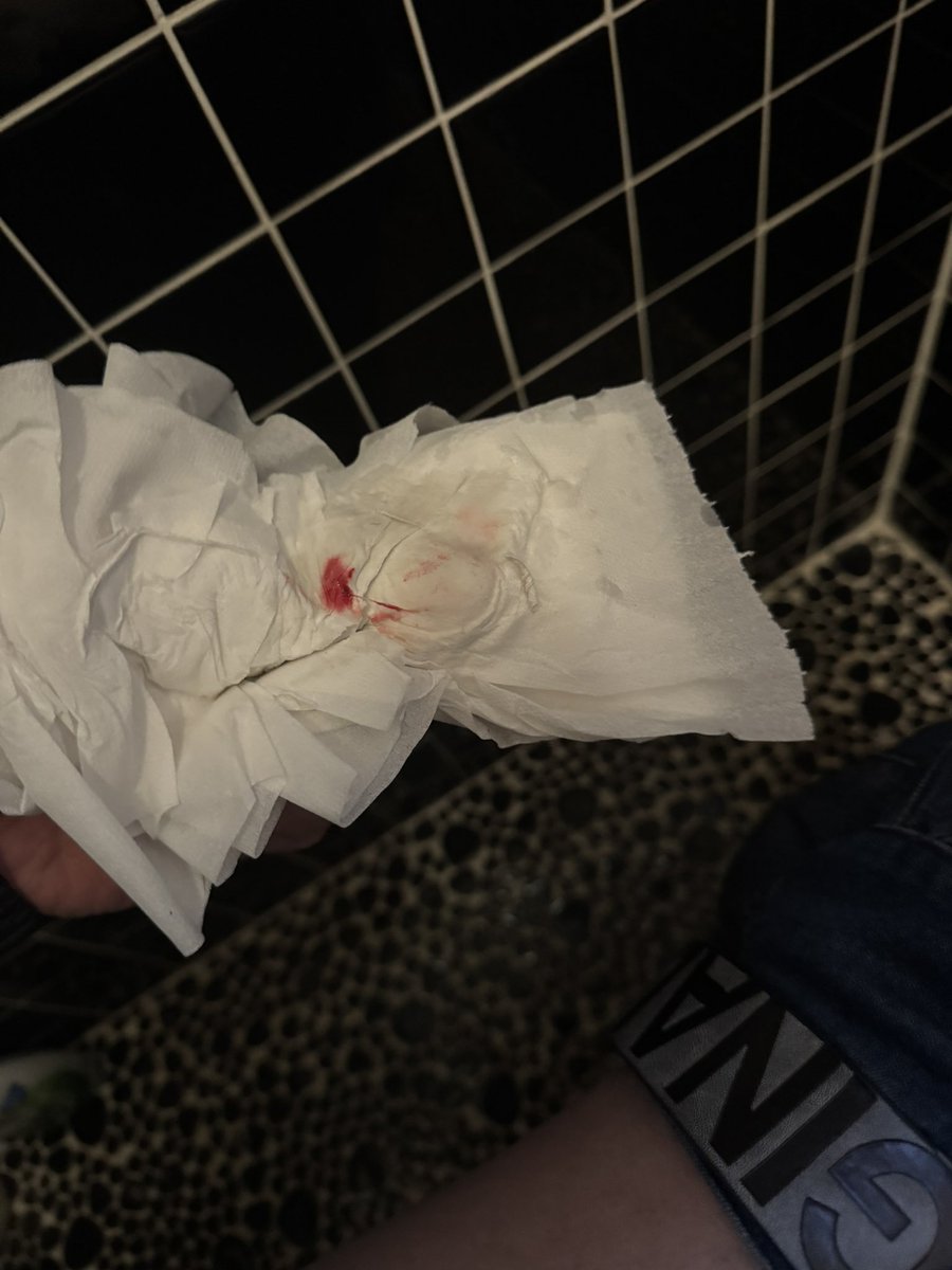 Post by ジャギ on X: また尻拭いたらw