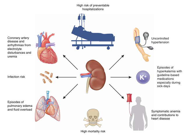 What are the drivers of preventable hospitalizations in patients with kidney diseases? And how can clinicians best intervene? This review in #ASNCJASN evaluates the current state of the science: kidney.pub/CJASN0879