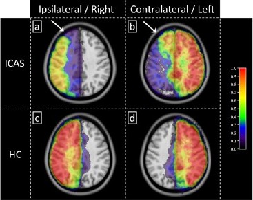 Journal of Neuroimaging tweet media