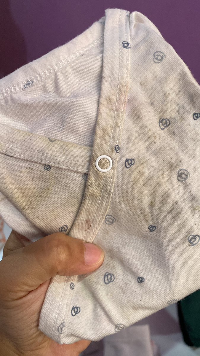Winiaprill's tweet photo. Bahkan, patch bekas tidurnya aja masih nempel. Kayak gak kena air cucian🥲 https://t.co/jNfiDCeJNu