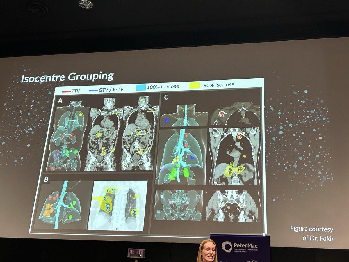 PBlanchardMD's tweet image. Tour de force talk by Melissa O Neil on polymetastatic SBRT at #SABR2025. 
Lessons learned from ARREST trials. Key principles of therapy. Is it the next #radonc frontier? Integration with biology and systemic therapy will be key as well.