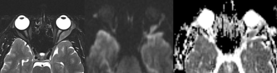 Daniel Gewolb, MD tweet media