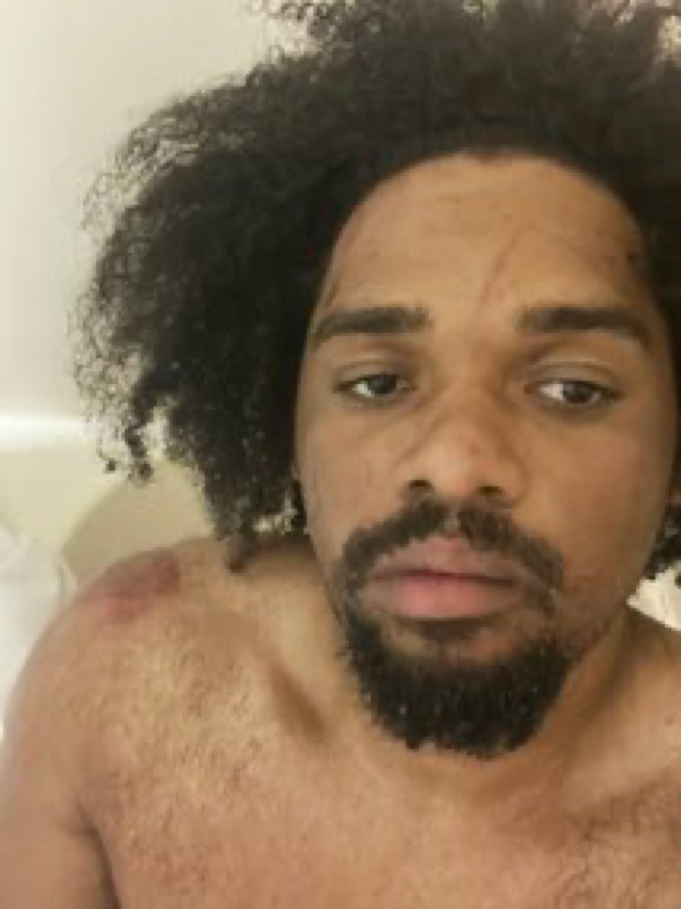 CANT BELIEVE YA NIGGAS JUMPED ME MAN SMH