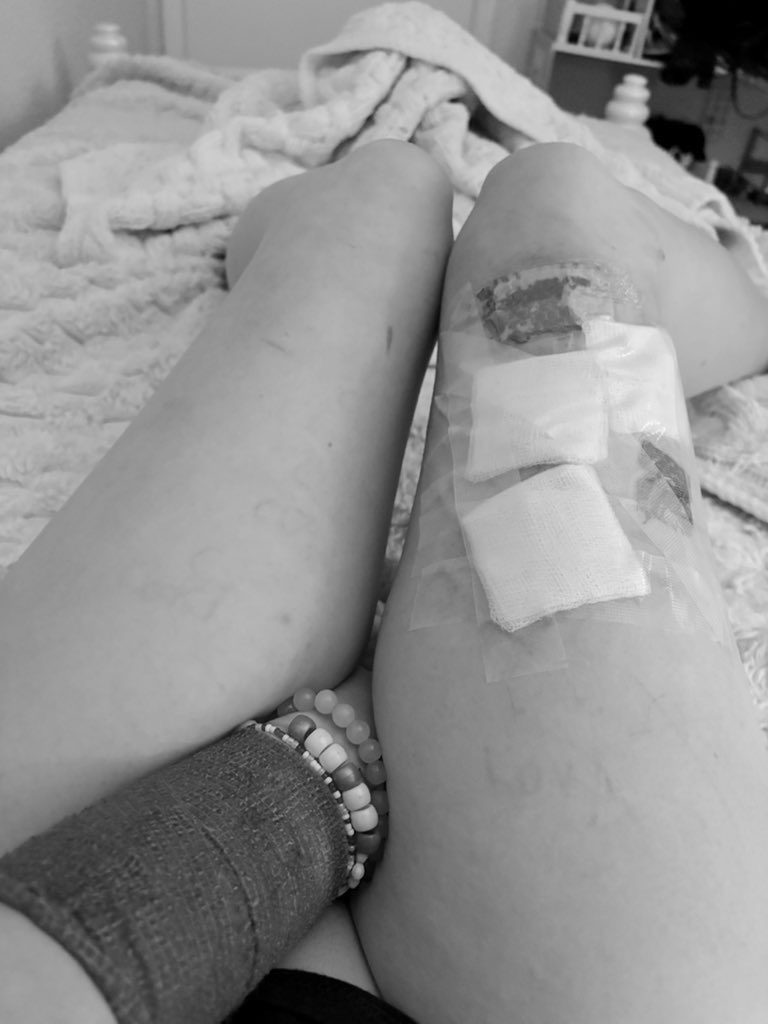 jestercultz's tweet image. Aftermath #shtwt #drugtwt #shedtwr #edtwt #anatwt