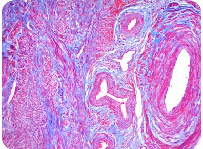CosmoBio_JPN's tweet image. 🧪Pick UP！組織染色🌈
トリクローム染色キット（Modified Masson&apos;s）

🔍こんな方におススメ
🔸安価に特定の構造を染色したい
🔹蛍光顕微鏡なしで観察したい

コラーゲン、筋繊維、核を検出します💡✨
ホルマリン固定パラフィン包埋（FFPE）切片で使用可能です😇

🔗詳細はこちら…