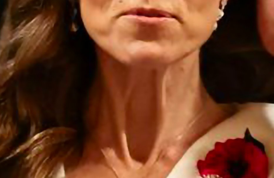 NSome1ne's tweet photo. Why is it so deep, deeper than the Great Blue Hole?
I'm talking about the sinkhole in #KateMiddleton's neck.
Every time I look at that pic and the other pics, especially that ๐, the first thing my eyes are drawn to is not her housekeeper's dress but her neck.
#ScaryShit ๐ฑ https://t.co/opNMkd9nDx