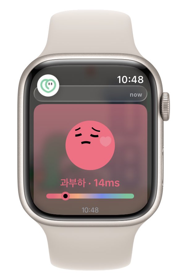 PAPERonNet's tweet image. 반성과 후회의 의자(치과)에 다녀왔어. 😐