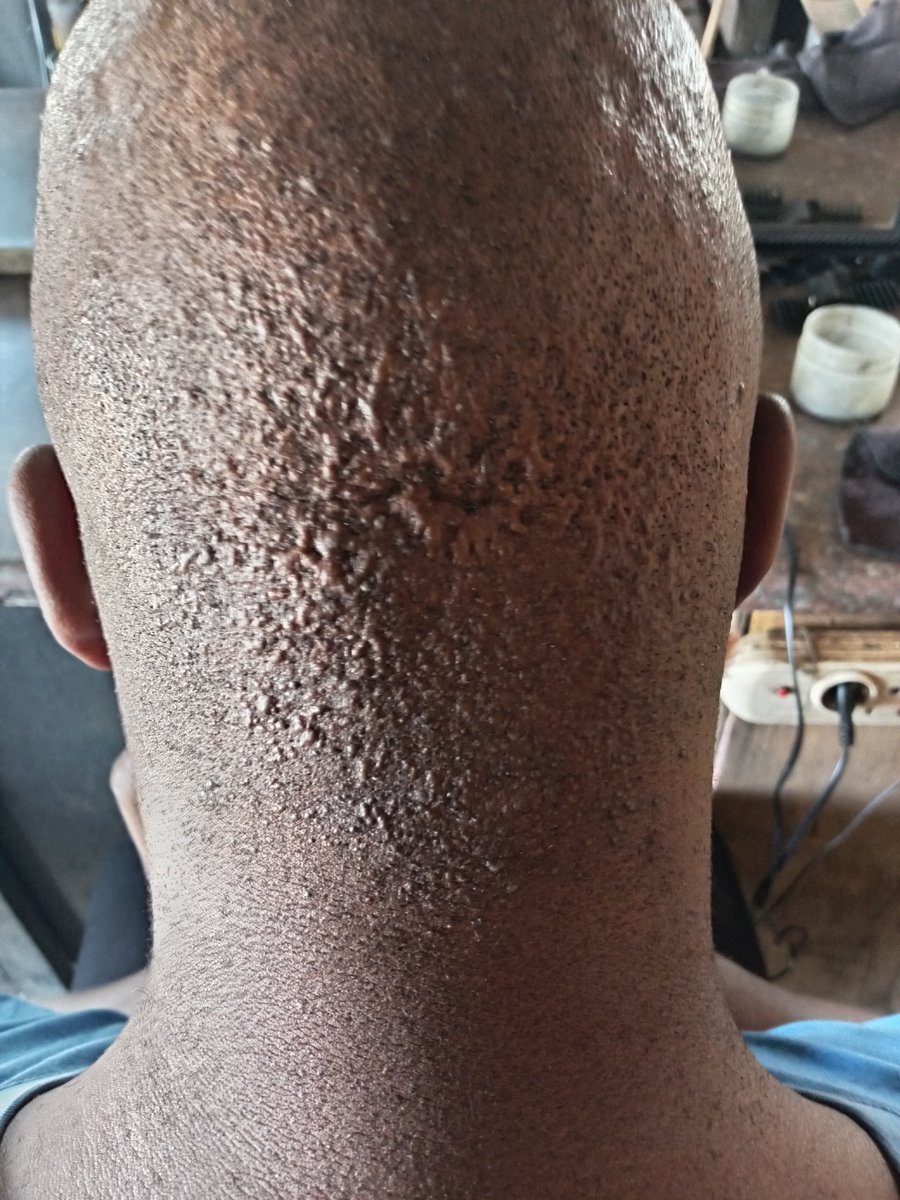 CdeLuckyLekgau🇿🇦 tweet media