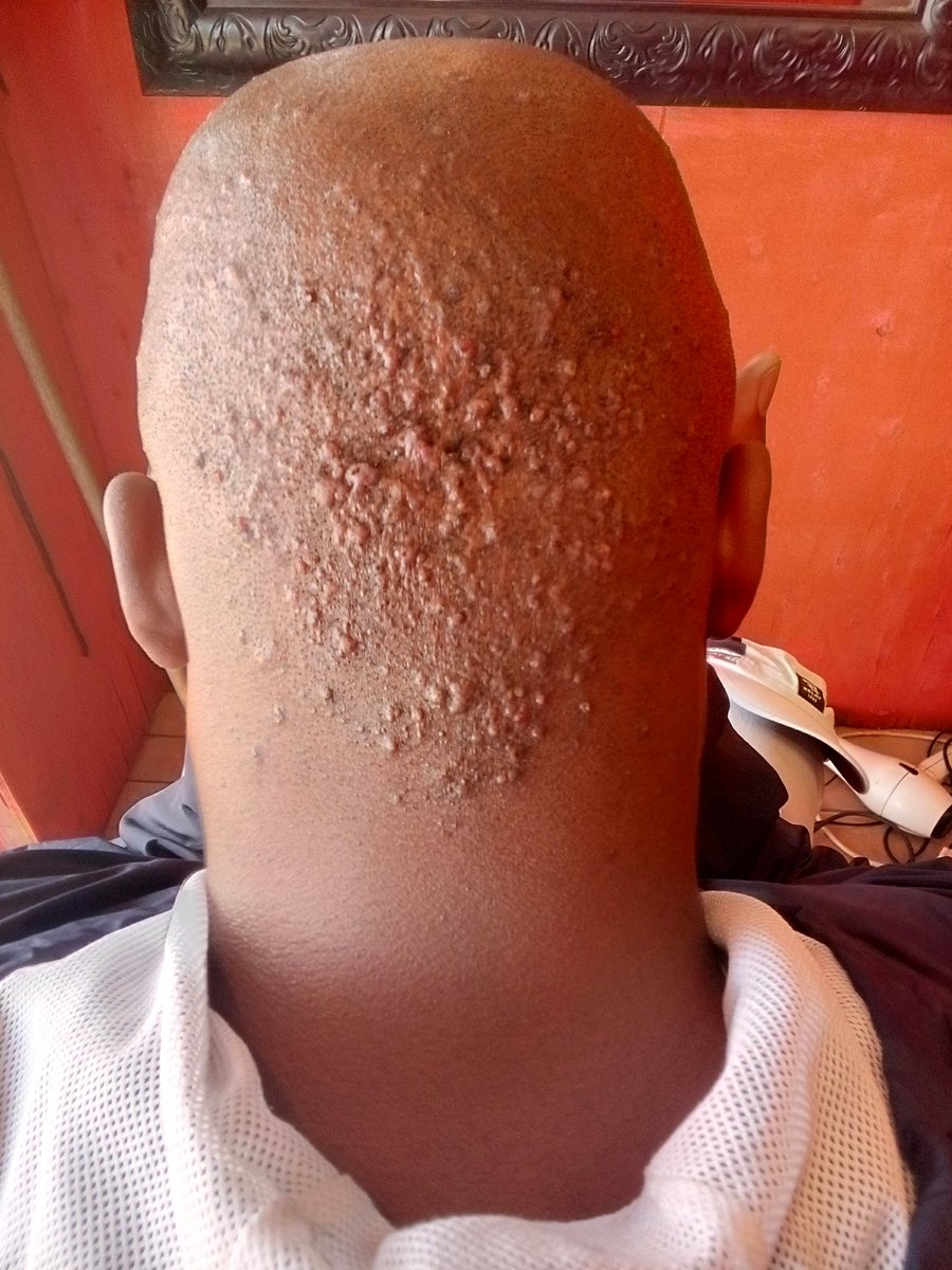 CdeLuckyLekgau🇿🇦 tweet media