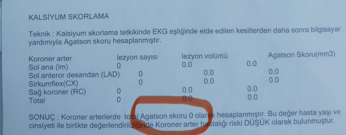A medical report titled KALSİYUM SKORLAMA shows coronary artery calcium scoring results with sections for Koroner (RC) Sol Ana (LAD) Sol Sirkümfleks (LCX) and Sağ Koroner (RCA) all with Agatston score of 0 volume 0 and mass 0 indicating no calcification detected in the arteries.