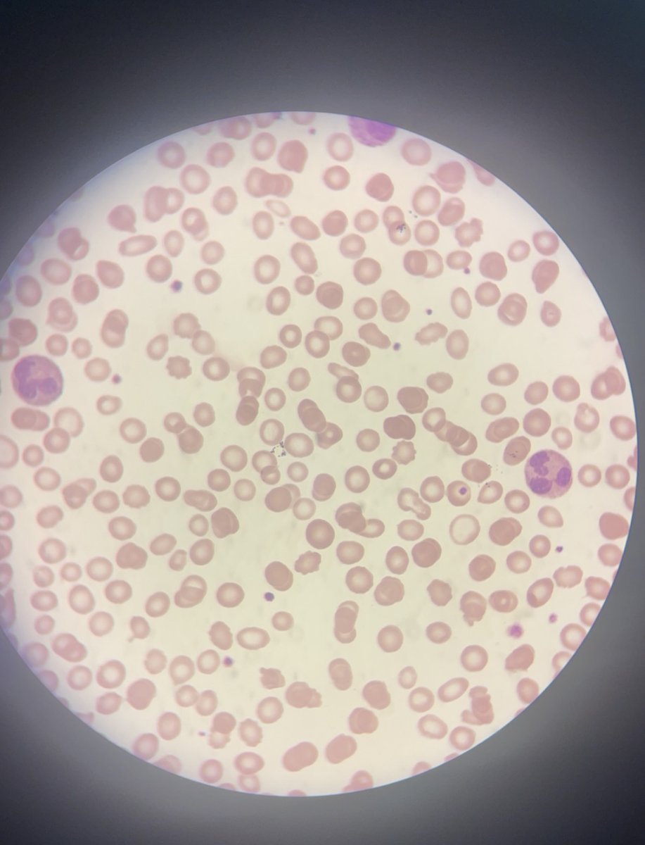 sa90053990's tweet image. تعليقكم على السلايد ؟ 

راح اختار ٥ من التعليقات الصحيحه يحصلون على كورس الهيماتولوجي مجاني ✨