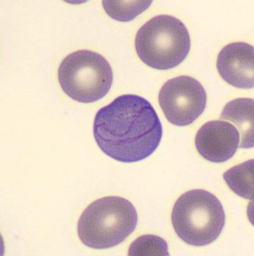 Blood smear of a vegan.

What do you see❓️

What do you say❓️