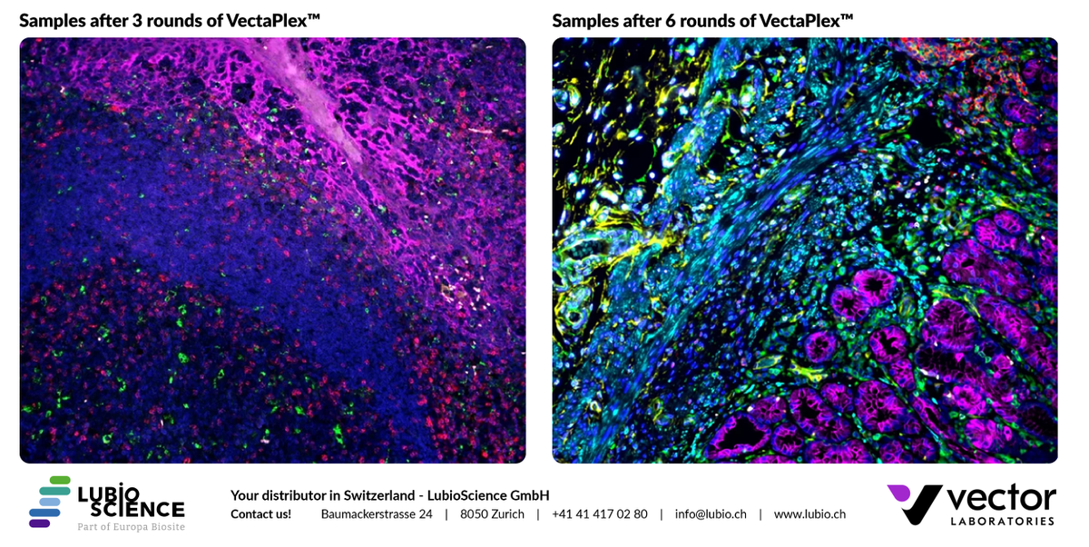 LubioScience's tweet photo. Have you tried the VectaPlex™ Antibody Removal Kit?

This convenient, ready-to-use solution efficiently removes antibodies and other non-covalently bound detection reagents from FFPE tissue sections - no harsh heating steps required!  👉 https://t.co/FXsMqObRgQ https://t.co/zsweCs1ID8