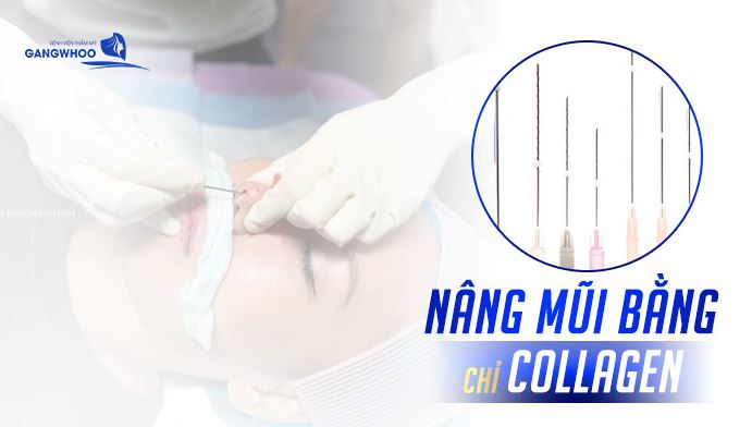 thammygangwhoo's tweet image. Nâng mũi bằng chỉ collagen có tốt không? Tìm hiểu an toàn, hiệu quả và cách chăm sóc sau nâng mũi để mũi đẹp tự nhiên.
#nangmui, #chicolagen, #thammy, #muidep, #chamsoc,
benhvienthammygangwhoo.vn/nang-mui-bang-…