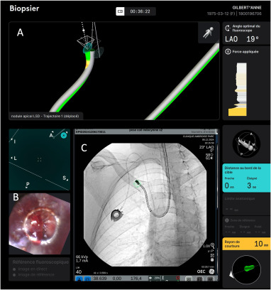 Laparoscopic, Endoscopic and Robotic Surgery tweet media