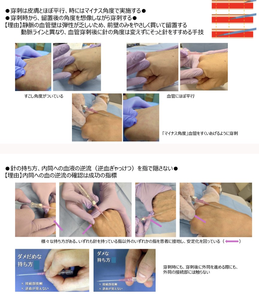 アプデしました