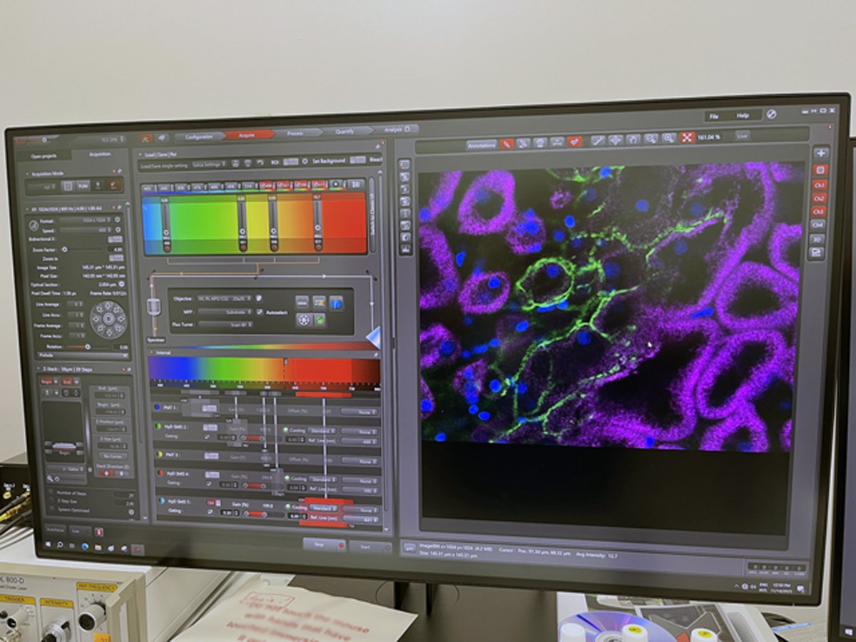 zebrafish_adam8's tweet image. ほら、いかにも放電できそうな局在をしてるだろう？