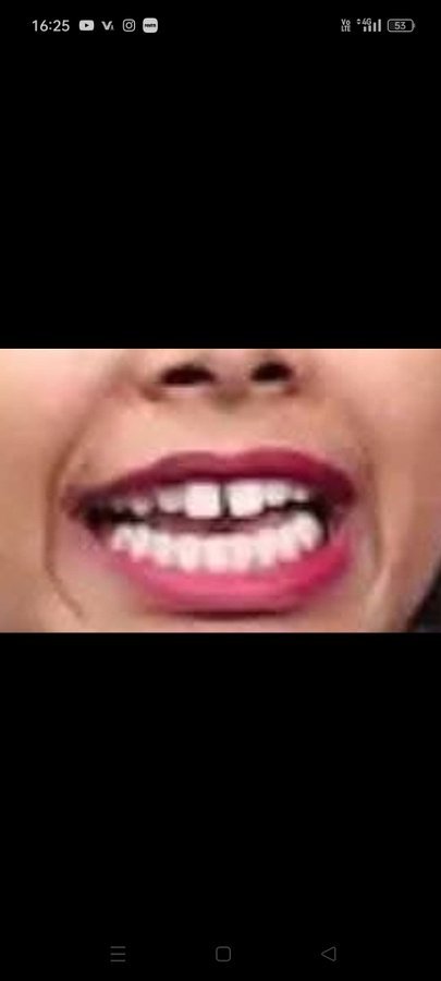 Jb thobda hi aisa ho to chunav koi kyse jit sakta hai 😁😹🤣🫣

#BiharElection2025