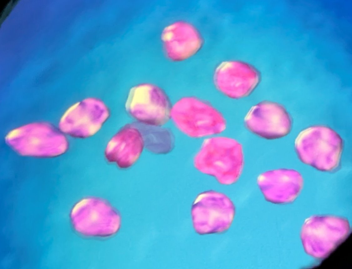 宝石と結婚運の不思議 ラッキー宝石 宝石の力が運命を変える | 高野