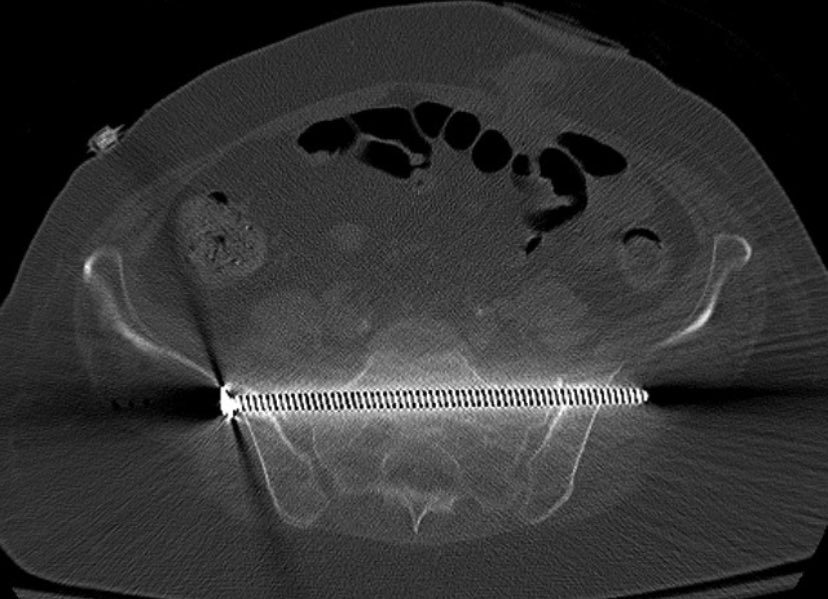 ML Chip Routt tweet media