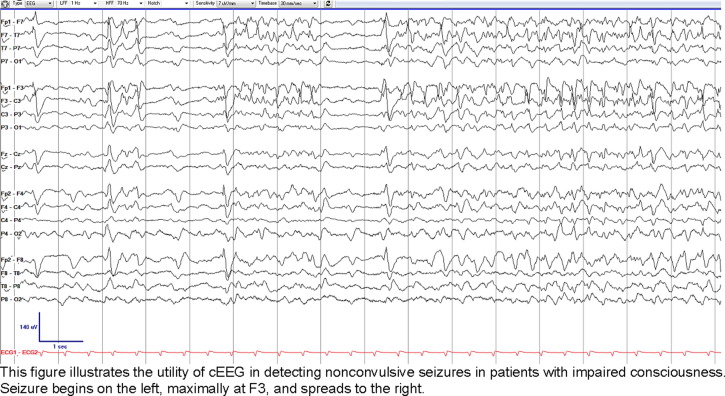 IFCN and its Clinical Neurophysiology journals tweet media