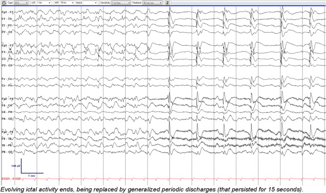 IFCN and its Clinical Neurophysiology journals tweet media