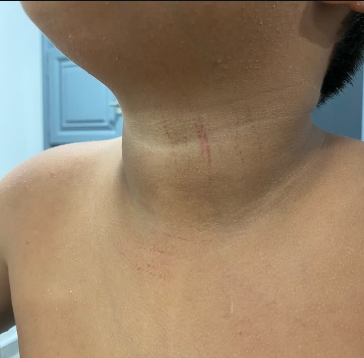 Carlos_Guedes's tweet photo. Nós já passamos por isto.
O ódio que as crianças vivem nas suas casas é transformado, depois, em mais ódio e violência nas escolas.
Foi assim, nos anos 90, com o ódio a ser dirigido à imigração de leste. É assim, agora. https://t.co/tJfzpDgFJ4