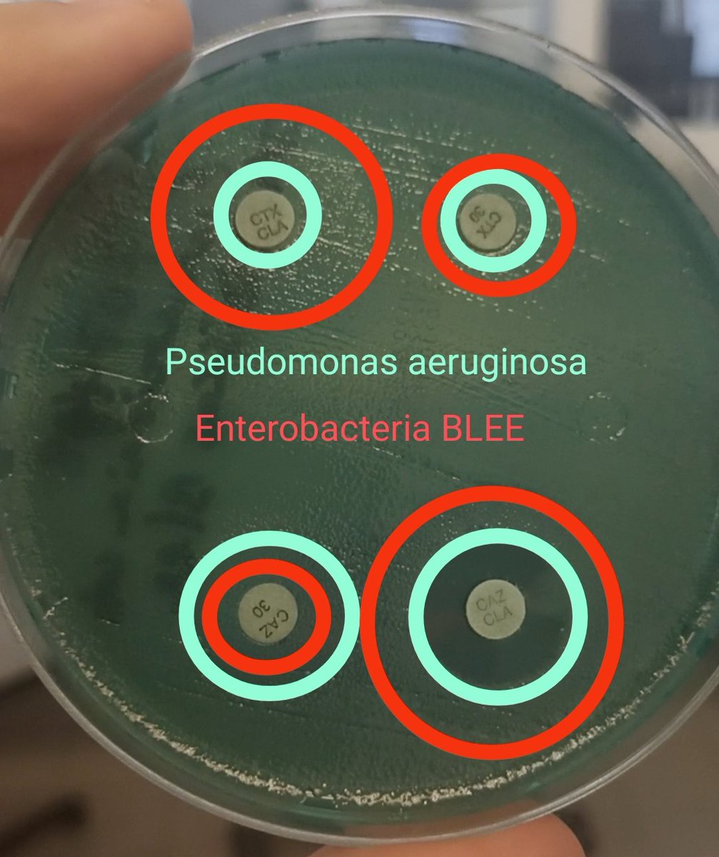 Ander González-Sarría tweet media