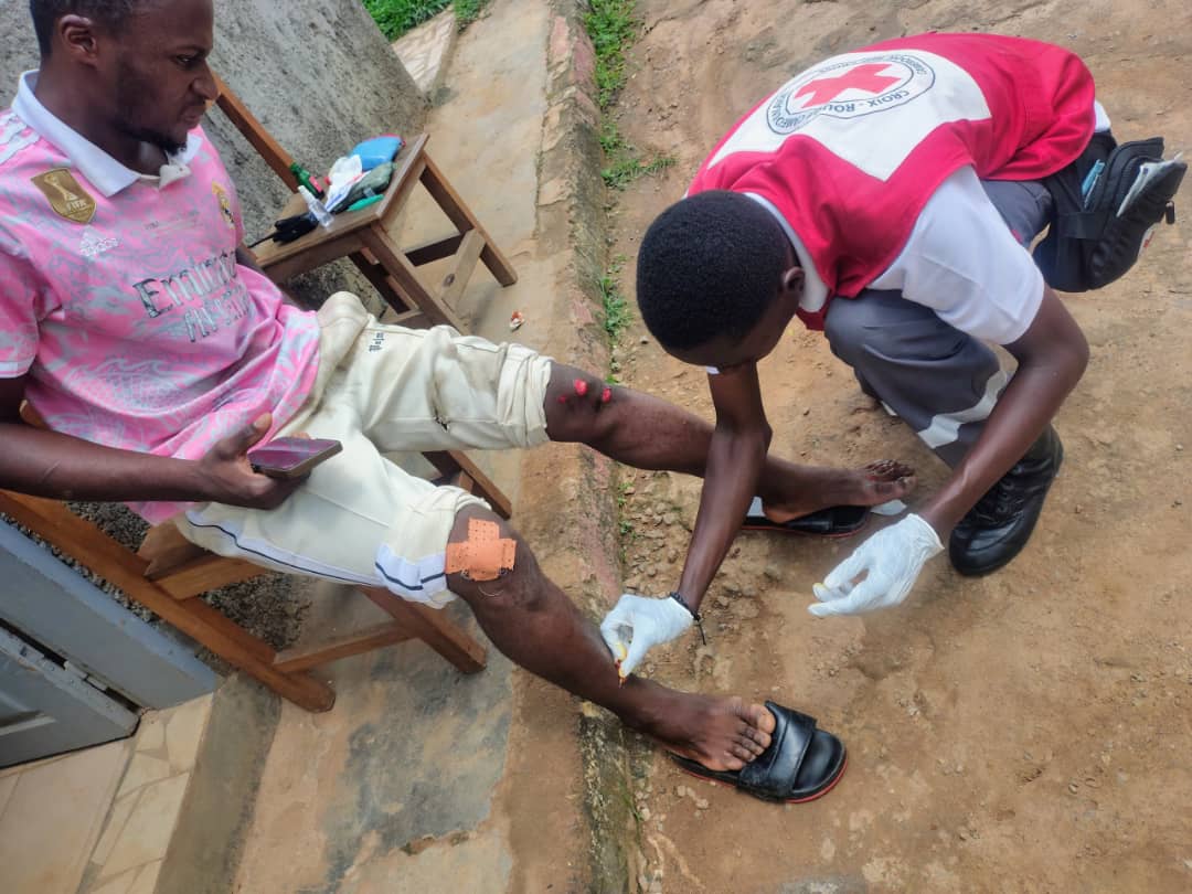 Les bénévoles du Comité d' Arrondissement de la Croix-Rouge de Mbé, Département de la Vina, Région de l'Adamaoua ont porté secours aux victimes de l' incendie  d’un camion transportant du carburant dans le village Haar situé dans l’arrondissement de Mbé .