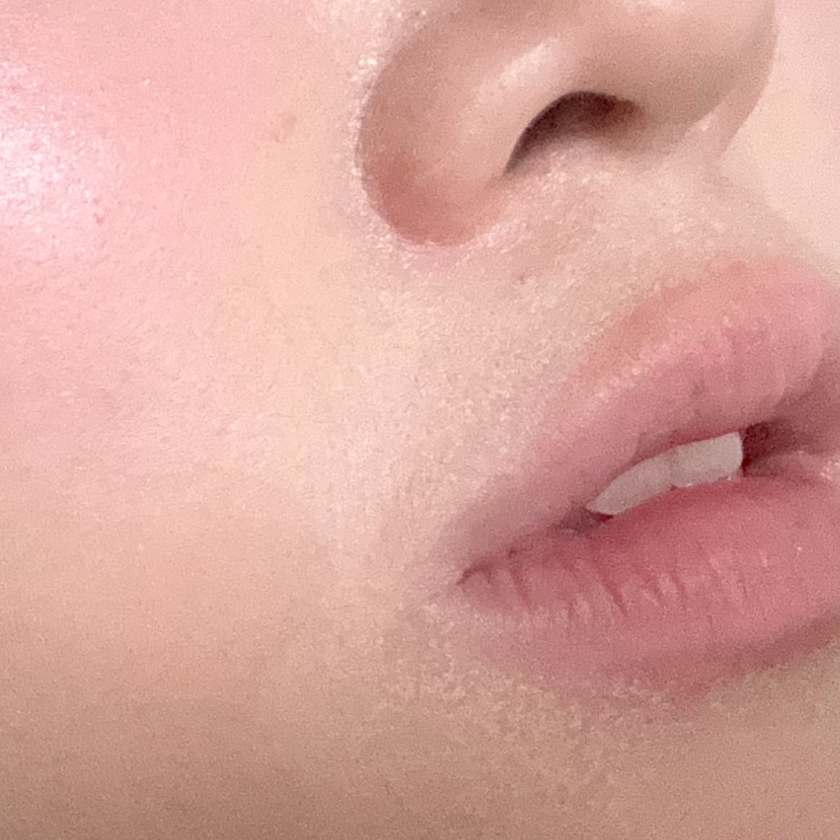 imtt178's tweet image. 열어분 저 원래
ㄴㅁ 건조해서 입 주변
저렇게 다 뜨는데

오늘 
VDL 베이스 프렙 + 아누아 결쿠션
썼더니!!!!!!!!
피부가하나도안떳어요
친구가 저 피부안뜬거처음본다고할정도로,
저도 놀라워요!!!!🥸🥸무보정피부예요