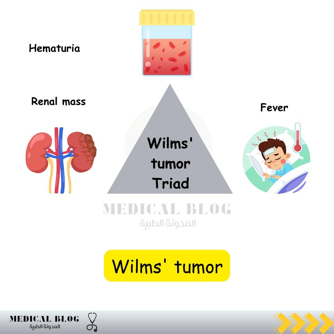 blog__medical's tweet image. Did you get it! 

The answer is: 
Wilms Tumor 

❓ What are the key clinical features of Wilms tumor? 

✨ Answer: 
• Abdominal mass 
• Hematuria 🩸 
• Hypertension 🔼 

 #Wilmstumor #Pediatrics #OncologyFacts #MedStudents #MedicalTriad