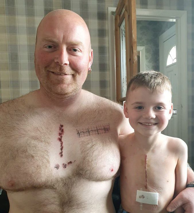 creepydotorg's tweet image. Father gets tattoo on chest to match scar from his son&apos;s heart operation.