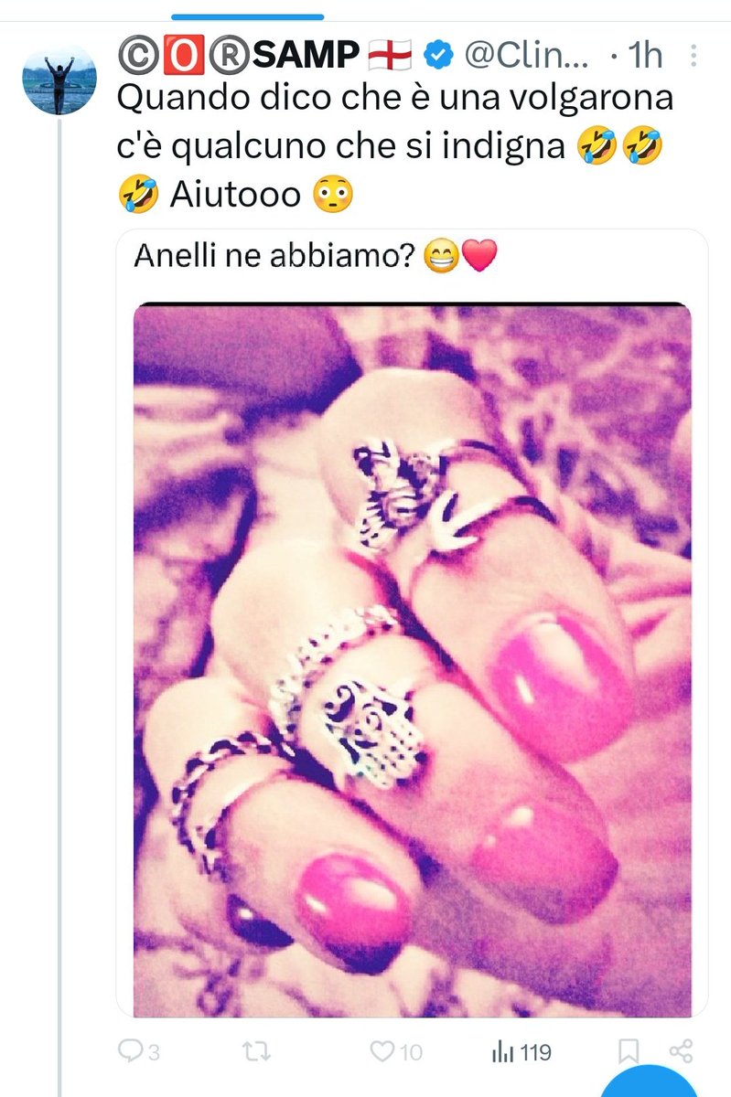 MoiMirue's tweet photo. Correva l'anno 2019 🤭... Avete capito bene 2019!!!
Come cambiano i tempi e le mode! 🤭Quello che non cambiano sono le tue molestie! #impazzite...
Mani 2025, solo per voi 🤭 https://t.co/4GdJZa53KX https://t.co/10A9FMbF6p