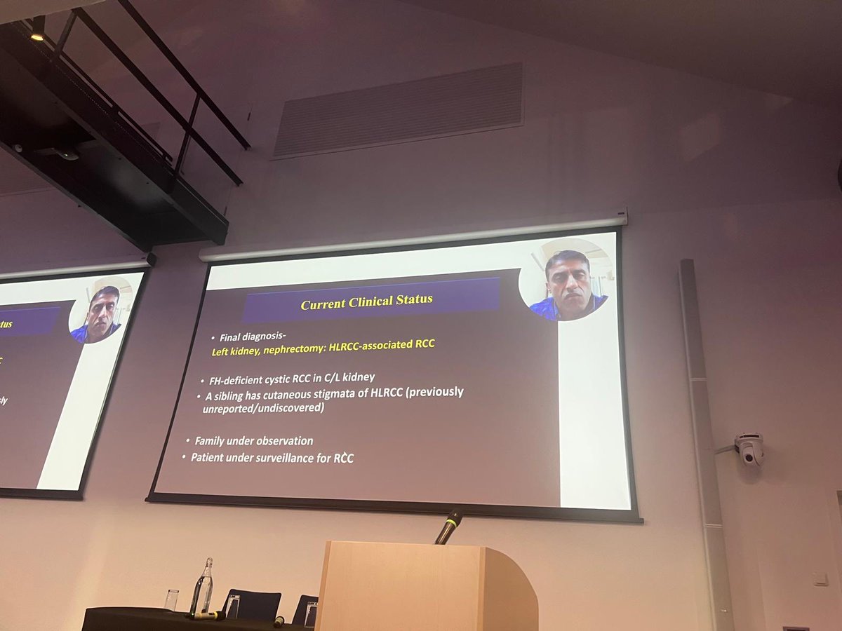 ⁦<a href="/drmehrarohit/">ROHIT MEHRA</a>⁩ sharing his expertise on high grade renal cell carcinomas at the ⁦<a href="/BritishDivIAP/">BDIAP</a>⁩ BAUP Uropathology symposium 2025