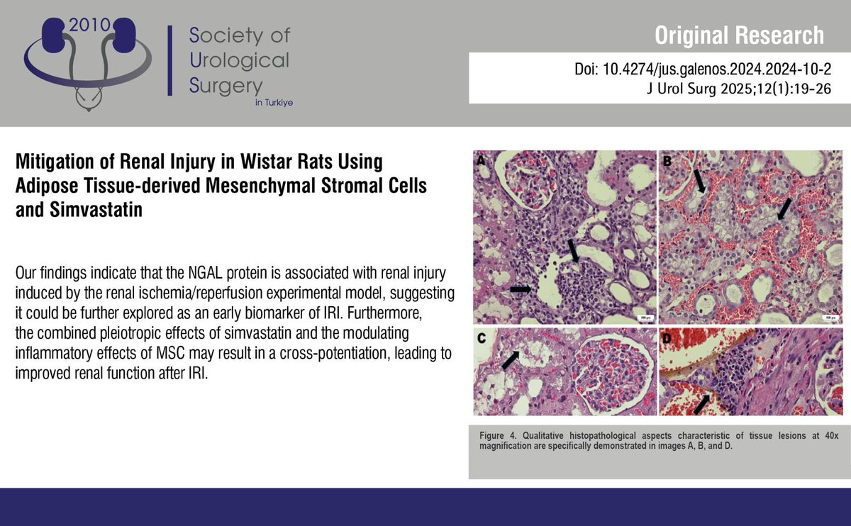 JUsurgery's tweet image. Mitigation of Renal Injury in Wistar Rats Using Adipose Tissue-derivedMesenchymal Stromal Cells and Simvastatin
You can see the free full text of the research by Daniela Boccasanta et al.
Link : jurolsurgery.org/pdf/a426c3a3-a…
#Basicscience #reconstructive #urology #transplantation