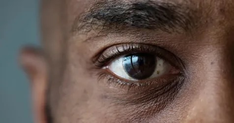 RetinaGlobal1's tweet image. In a study published by authors from Wills Eye Hospital, Kaiser Permanente &amp;amp; Genentech, it was found that at 2 years, black &amp;amp; white patients who received #Lucentis (#ranibizumab) for the treatment of diabetic macular edema achieved similar levels of best corrected visual acuity.